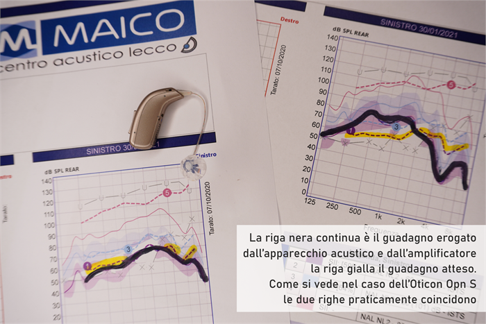 Amplificatore acustico vs apparecchio acustico. Li abbiamo messi a confronto, e...